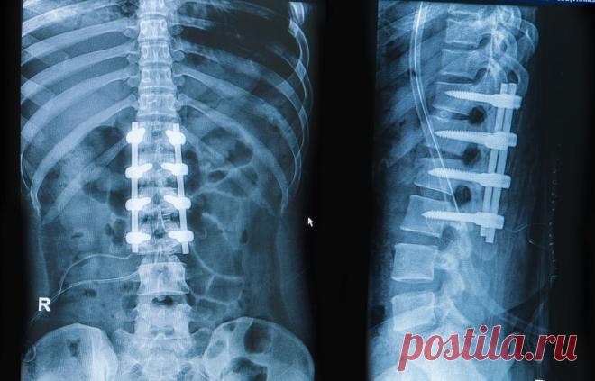 ВНИМАНИЕ! ОРТОПЕДИЧЕСКИЕ КОНСУЛЬТАЦИИ! С 26 по 27 ноября 2016 года немецкий профессор Роланд Беккер проводит ортопедические консультации по адресу:
город Москва, улица Трифоновская 11, (метро Марьина роща или метро Достоевского).
Записаться на консультацию к профессору можно по телефону
+7 (495)961-12-20,
+7 (495)120-46-92,
воспользовавшись электронной почтой info@euromed.academy или формой обратной связи сайта  www.wp-german-med.ru