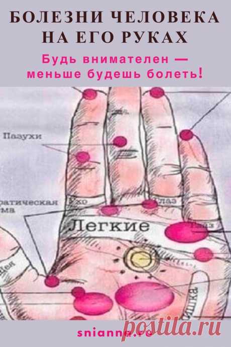 Болезни человека — на его руках. Будь внимателен — меньше будешь болеть!

Стимулируя любым способом (тепло, надавливание, эфирные масла) эти точки, вы стимулируете работу внутренних органов. Руки — кладезь всевозможной информации ➡️ Кликайте на фото, чтобы прочитать полностью