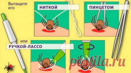 12 видов укусов насекомых и что делать при каждом из них (часть 1)
Клещ. Наиболее опасен для человека лесной клещ, так как он является переносчиком...
Читай пост далее на сайте. Жми ⏫ссылку выше