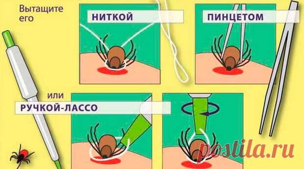 12 видов укусов насекомых и что делать при каждом из них (часть 1)
Клещ. Наиболее опасен для человека лесной клещ, так как он является переносчиком...
Читай пост далее на сайте. Жми ⏫ссылку выше