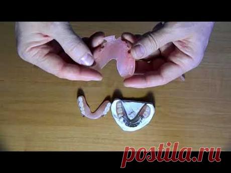 Нейлоновые зубные протезы-"плюсы"и "минусы"