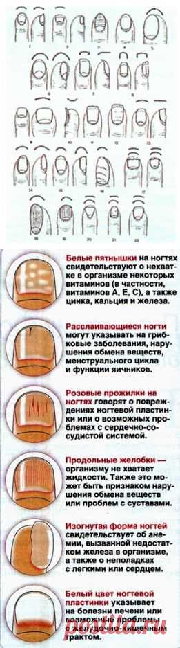 О КАКИХ ЗАБОЛЕВАНИЯХ ГОВОРЯТ ИЗМЕНЕННЫЕ НОГТИ))