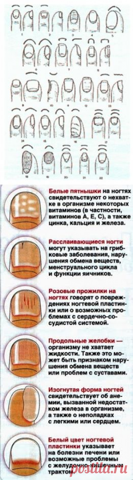 О КАКИХ ЗАБОЛЕВАНИЯХ ГОВОРЯТ ИЗМЕНЕННЫЕ НОГТИ))