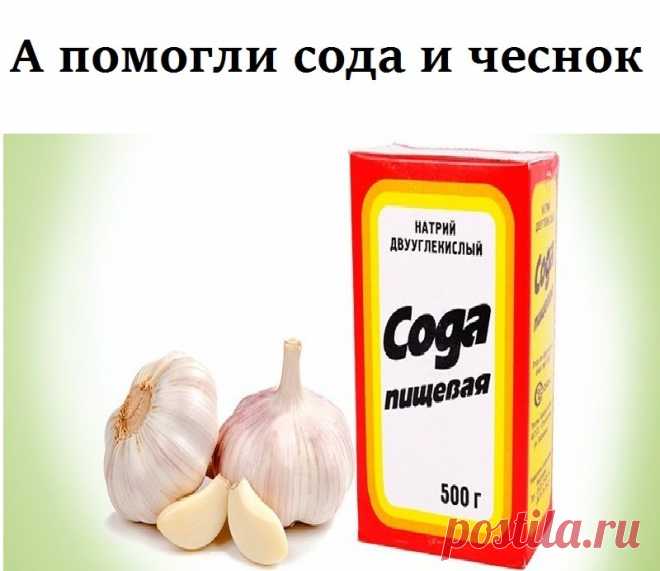 А помогли сода и чеснок У меня был хронический бронхит, эмфизема легких. По два раза в год болела пневмонией и думала, что мне от этого не избавиться никогда.