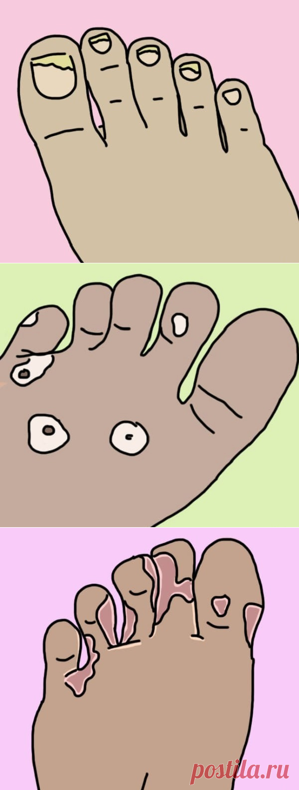 Как справиться с самыми распространенными проблемами ног