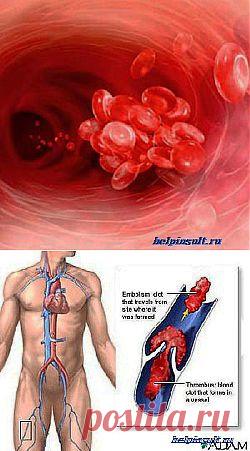 Средства для разжижения крови |
