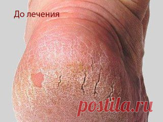 (12) Одноклассники