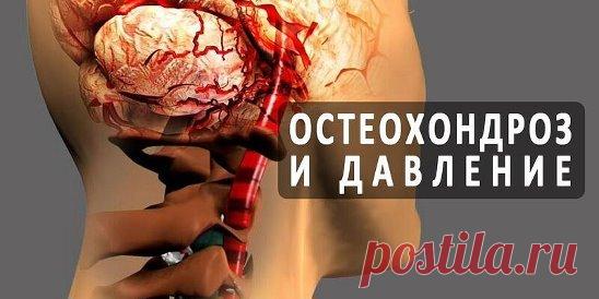 Шейный остеохондроз и скачки давления всегда неразлучная парочка..