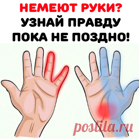 Длительное времяпрепровождение в позе, когда одна рука перекинута через подлокотник. Это приводит к давлению на нервные окончания, что вызывает определенный дискомфорт.

Ношение тяжелой сумки или рюкзака. Давление в этом случае будет оказываться его лямками. Онемение возникает на фоне нарушения кровоснабжения конечности.

Ношение слишком тесной одежды.

Частый подъем рук выше плеч.

Длительное время препровождение на холоде. Онемение возникает из-за спазма сосудов.