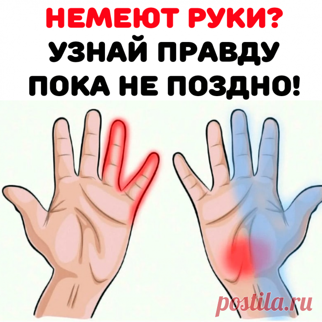 Длительное времяпрепровождение в позе, когда одна рука перекинута через подлокотник. Это приводит к давлению на нервные окончания, что вызывает определенный дискомфорт.

Ношение тяжелой сумки или рюкзака. Давление в этом случае будет оказываться его лямками. Онемение возникает на фоне нарушения кровоснабжения конечности.

Ношение слишком тесной одежды.

Частый подъем рук выше плеч.

Длительное время препровождение на холоде. Онемение возникает из-за спазма сосудов.