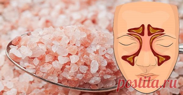 Вдыхание этой соли останавливает синусовые инфекции, уменьшает слизь и помогает вам спать 


Розовая гималайская соль обладает множеством полезных лечебных свойств, богата 84 минералами и микроэлементами.







 


Ее можно использовать в качестве замены обработанной поваренной соли, в ка…