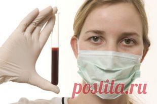 Диагноз в наследство: что такое гемофилия и чем она опасна | Здоровая жизнь | Здоровье | Аргументы и Факты