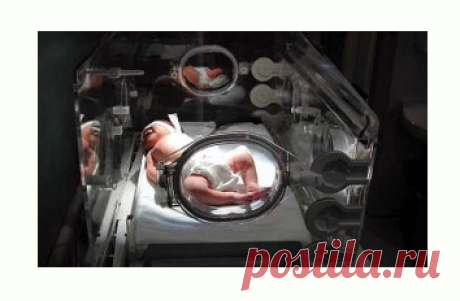 Premature babies