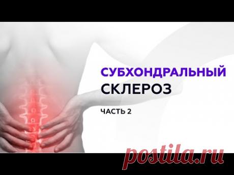2 часть. Врач-ортопед Мусин У.К. о субхондральном склерозе