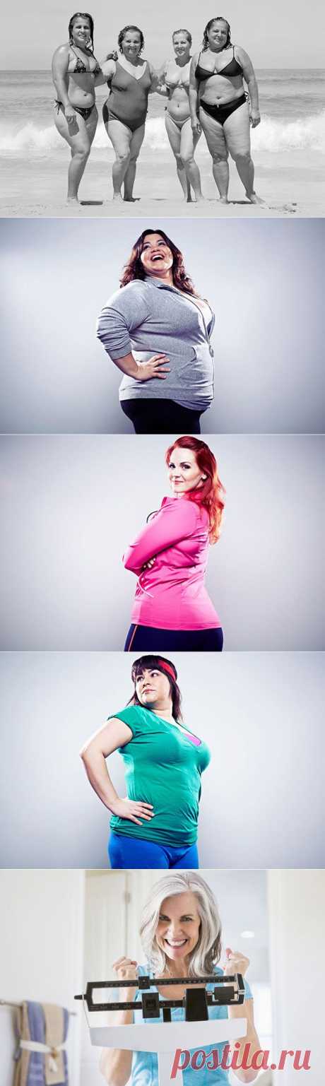 Схема отложения излишеств на фигуре: «яблоко», «груша», «банан»