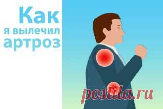 Как я вылечил артроз. | Сообщество Здоровых Людей.
