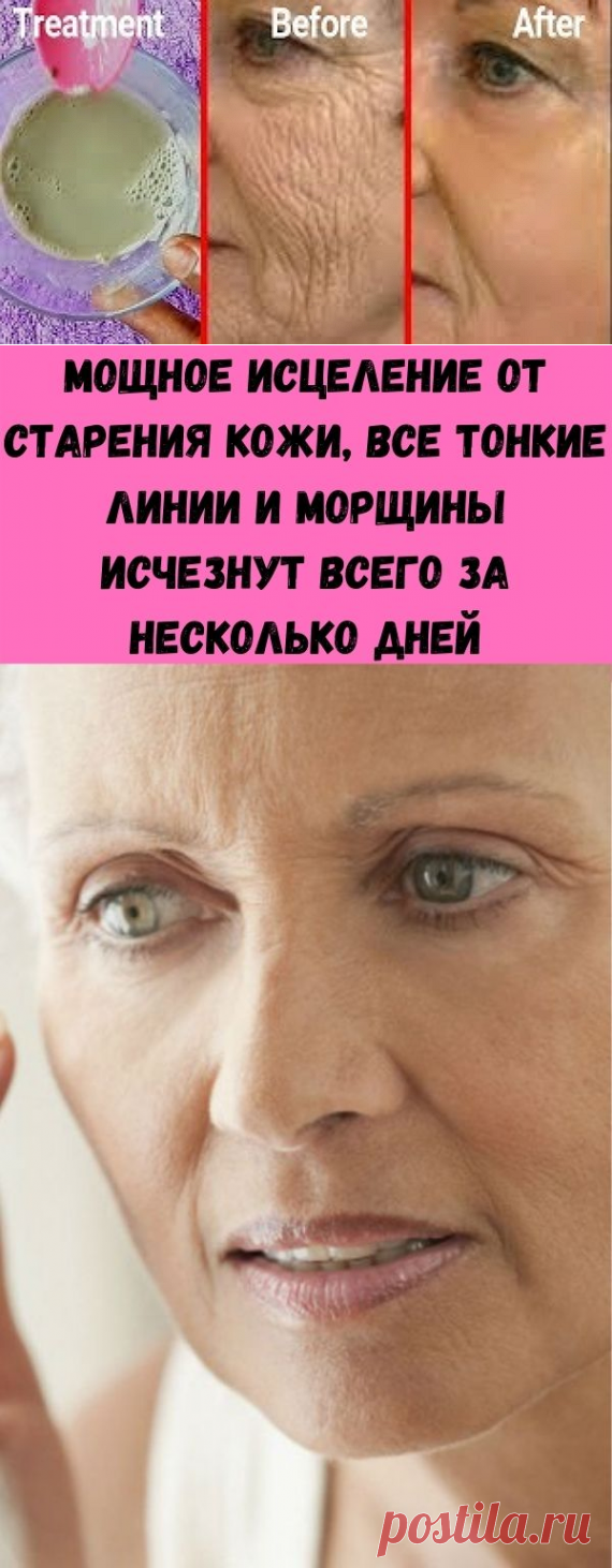 Мощное исцеление от старения кожи, все тонкие линии и морщины исчезнут всего за несколько дней - Стильные советы