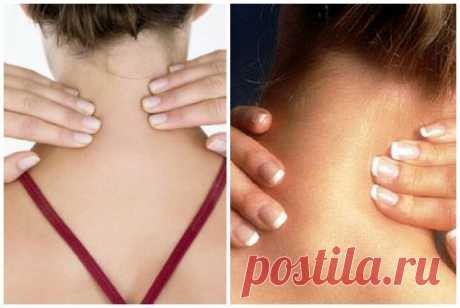 Вдовий горбик - как убрать или вылечить.