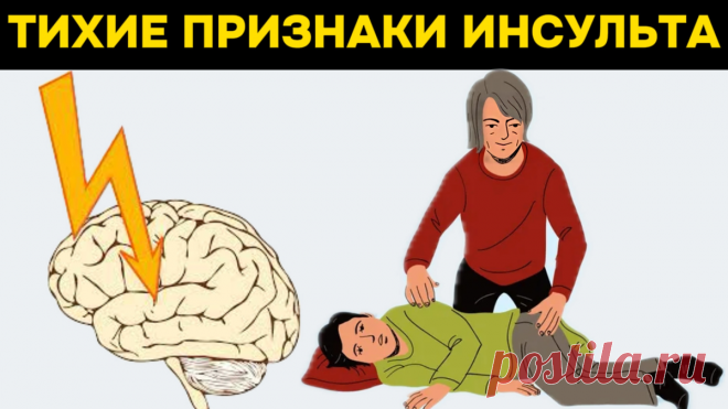 8 тихих признаков инсульта, которые мы никогда не должны игнорировать | Игорь Ботоговский | Дзен