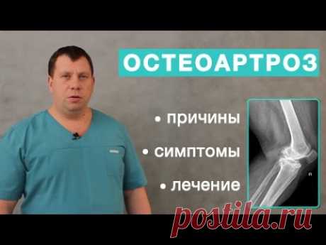 Остеоартроз. Причины, симптомы и лечение остеоартроза. Отличие артрита от остеоартроза