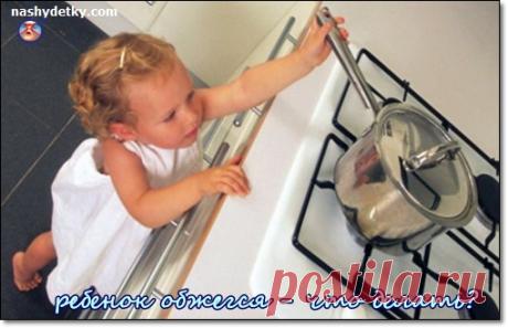 Ожоги у детей. Ребенок обжегся - что делать?