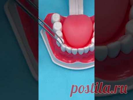 Импланты, коронки, исправление прикуса — ZemsClinic.ru #shorts #стоматологиямосква #лечениезубов