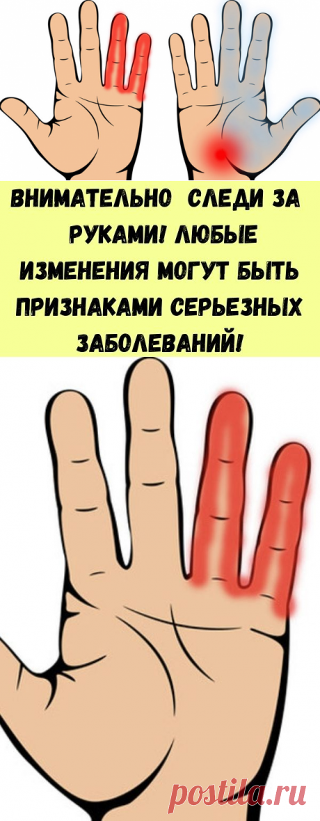 Внимательно следи за руками! Любые изменения могут быть признаками серьезных заболеваний! - Советы для тебя