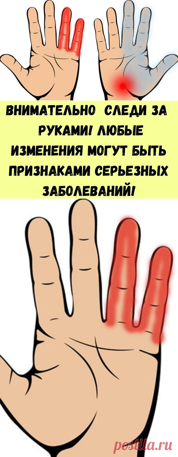 Внимательно следи за руками! Любые изменения могут быть признаками серьезных заболеваний! - Советы для тебя