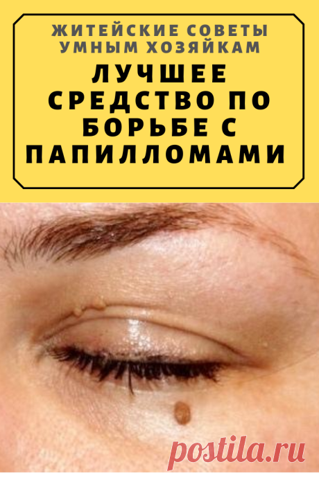 Лучшее средство по борьбе с папилломами — яйца! | Житейские Советы