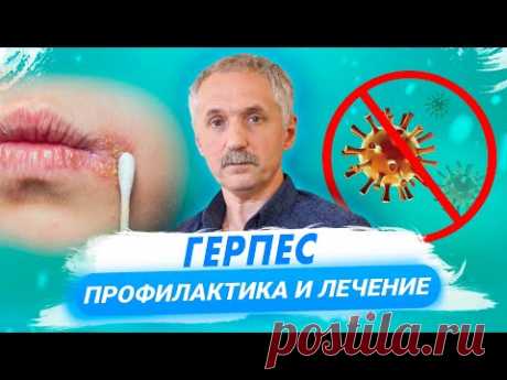 Причины появления герпеса, методы его диагностики и лечения / Доктор Виктор