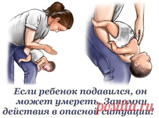 Подавиться или поперхнуться может любой, как взрослый, так и ребенок. Но с детьми ситуация сложнее: они...#красотаздоровье...