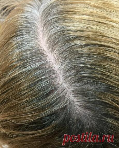 Картофельные очистки и седина | Наши ручки творят чудеса. | Яндекс Дзен