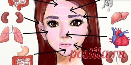 Почему прыщи появляются в определенных местах вашего тела? На все есть свои причины. 
Традиционная китайская медицина называет лицо «окном к нашему здоровью». Лоб, брови, подбородок, нос, щеки — их состояние прямо указывает на то, что происходит внутри нашего тела. 
Сейчас мы расскажем о том, о чем могут сообщить вам прыщи и другие проблемы с кожей на лице. 
Прыщи на верхней части лба
Верхняя часть вашего лба напрямую связана с пищеварительной системой — толстым кишечником и мочевым пузыре