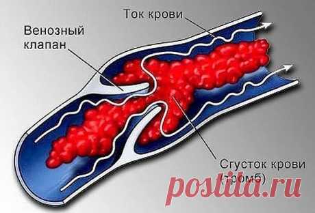 Не хочешь тромбов, просто пей этот коктейль