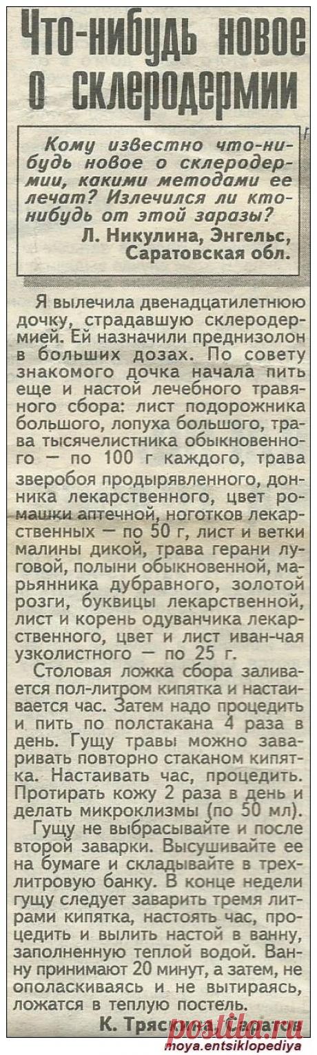 Склеродермия