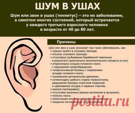 Топ-10 самых лучших препаратов от шума в ушах - Неврология и нейрохирургия - Статьи - Поиск Лекарств