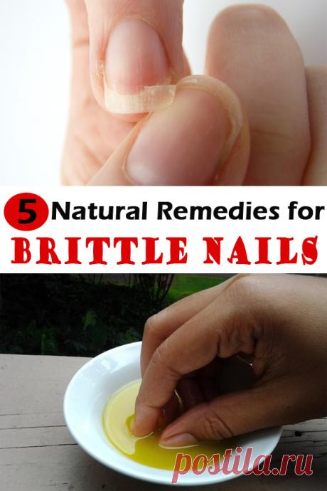 5 Natural Remedies for Brittle Nails - Inspirational Ideas and Tips Are your nails brittle and you fail to let them grow? Learn how to keep them as healthy as possible with the help of herbal remedies!