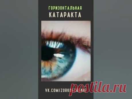 Горизонтальная катаракта.Shorts