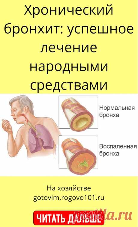 Хронический бронхит: успешное лечение народными средствами