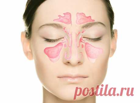 Гайморит: правильное лечение / Будьте здоровы