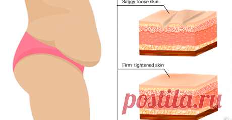 7 простых способов, которые помогут подтянуть провисшую кожу естественным способом Вы будете удивлены! Здоровье и упругость нашей кожи зависит от двух структурных белков: коллагена и эластина. Из-за относящих к окружающей среде токсинов
