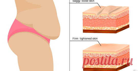 7 простых способов, которые помогут подтянуть провисшую кожу естественным способом Вы будете удивлены! Здоровье и упругость нашей кожи зависит от двух структурных белков: коллагена и эластина. Из-за относящих к окружающей среде токсинов