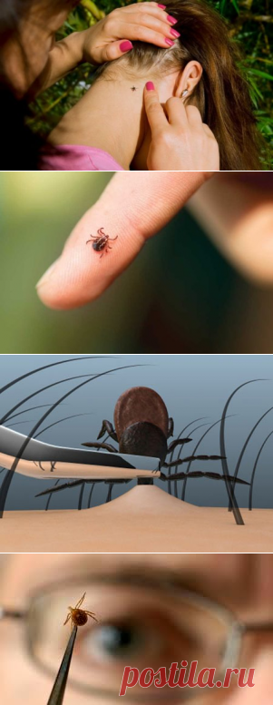 Укус клеща - что делать если укусил клещ. Пошаговая инструкция по извлечению клеща.