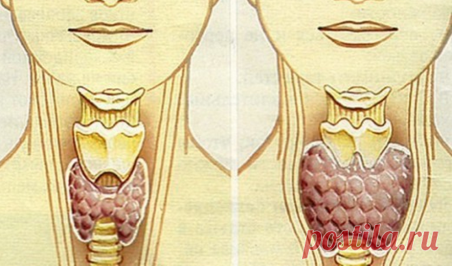 Смешайте по одному стакану гречневой крупы, грецких орехов и меда -  Как привести в порядок щитовидку