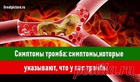 Симптомы тромба 
 Симптомы тромба: симптомы,которые указывают, что у вас тромбы.Информация, которую лучше запомнить! 💟.Это нужно знать.Сгустки крови, которые образуются в венах, могут быть очень опасными. Знание симп…