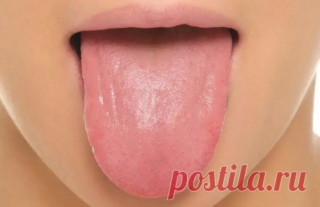 Что язык может рассказать о вашем здоровье
Здоровый язык имеет розовый или слегка белый цвет и покрыт небольшими узелками — сосочками. Они помогают различать вкус и температуру пищи. Если язык выглядит иначе, возможно, в организме что-то сломалось. Попросили нашего стоматолога Любовь Ивановну Копылову рассказать, на какие проблемы со здоровьем могут указывать изменения языка. Если на языке появились белый налет или белые пятна […]
Читай пост далее на сайте. Жми ⏫ссылку выше