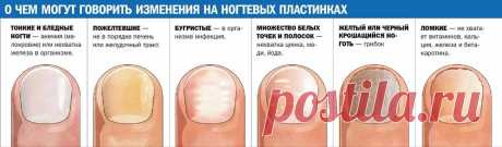 белые пятна на ногтях пальцев рук причина у женщин: 11 тыс изображений найдено в Яндекс.Картинках