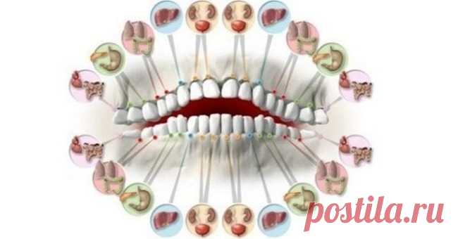 Каждый зуб связан с определенным органом в вашем теле Вряд ли найдется много счастливчиков, которые никогда в жизни не испытывали «прелести» зубной боли. И хотя зачастую зубная боль свидетельствует о заболеваниях десен или кариесе, в некоторых случаях он…