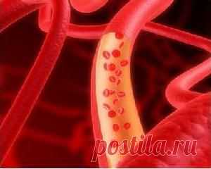 Очищение сосудов