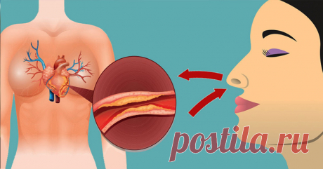 Самая большая проблема заключается в том, что это «тихий убийца», потому что она обычно развивается, не проявляя симптомов. Высокое кровяное давление увеличивает сопротивление кровотоку в сосудах. Это заставляет сердце...
